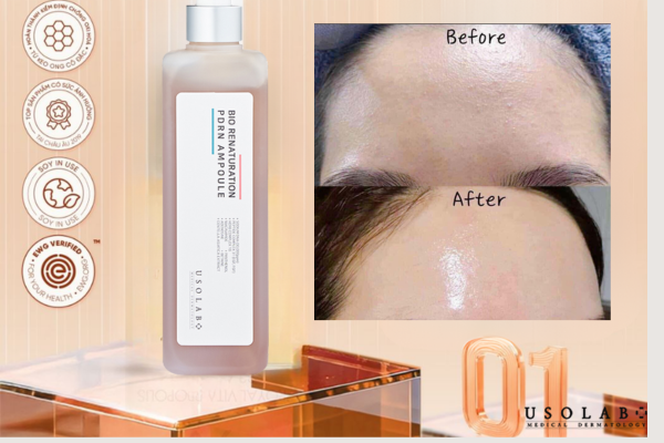 Tinh chất tế bào gốc cô đặc giúp phục hồi, chống lão hoá da