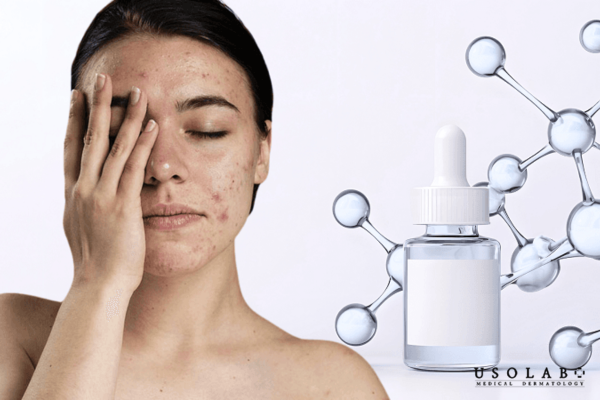 Serum phục hồi da nhiễm corticoid có thật sự cần thiết không