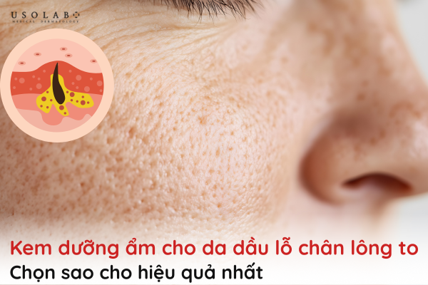 kem dưỡng ẩm cho da dầu lỗ chân lông to