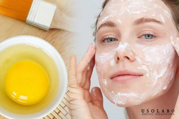 Lòng trắng trứng gà từ lâu được xem là nguyên liệu làm đẹp tự nhiên