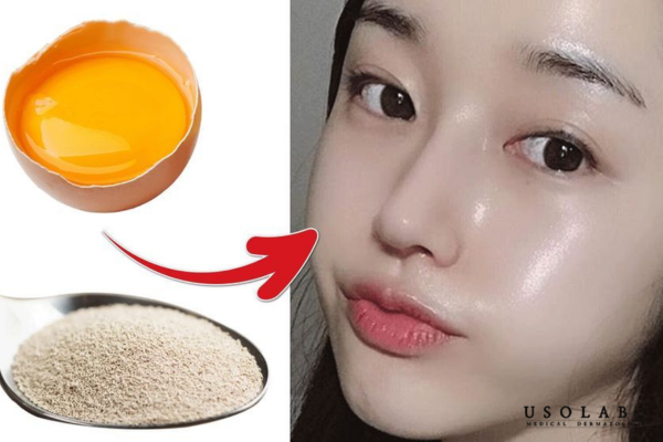 Chọn trứng tươi, có nguồn gốc rõ ràng, làm sạch da kỹ trước khi đắp