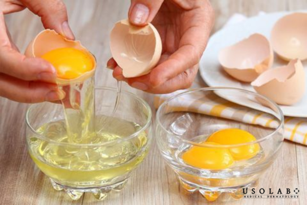 Trứng gà mang đặc tính sinh học khác nhau và phù hợp với từng tình trạng da cụ thể