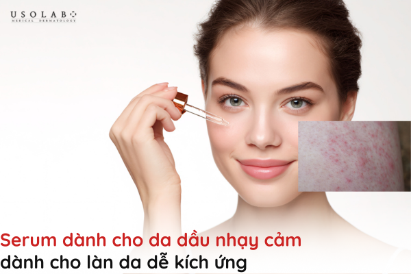 serum dành cho da dầu nhạy cảm