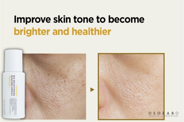 Tinh chất trắng da USOLAB
