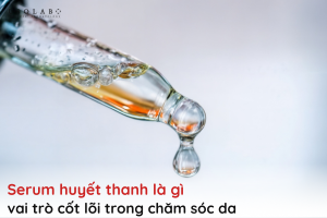 serum huyết thanh là gì