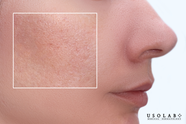 Không chứa các chất gây kích ứng: