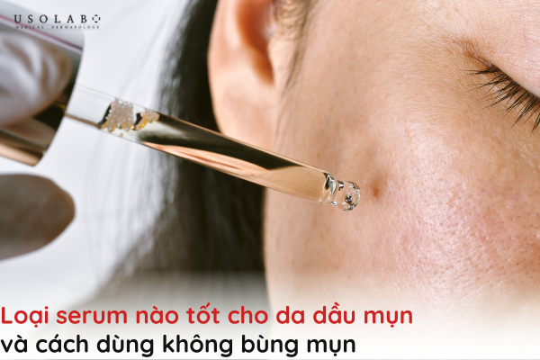 loại serum nào tốt cho da dầu mụn
