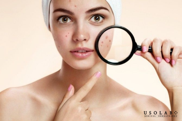 Làm dịu da, giảm viêm và kích ứng, phục hồi hàng rào bảo vệ da