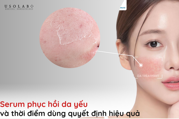 serum phục hồi da yếu