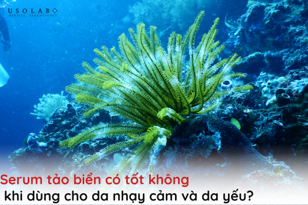 serum tảo biển có tốt không