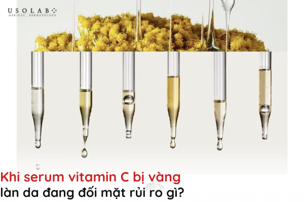serum vitamin c bị vàng