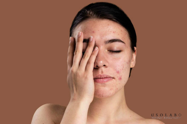 tự làm kem dưỡng trắng da mặt