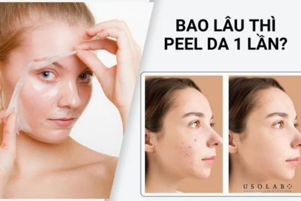 Người mới bắt đầu chỉ nên thực hiện 7–10 ngày/lần