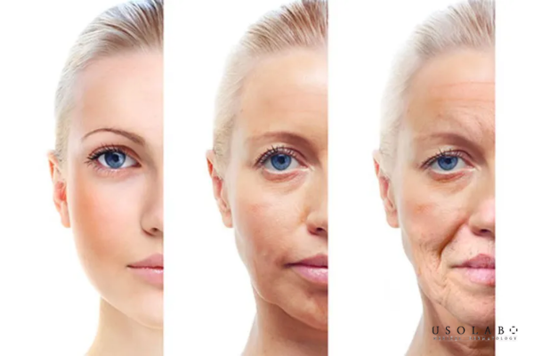 Người có da dầu, da hỗn hợp thiên dầu, bít tắc nhẹ