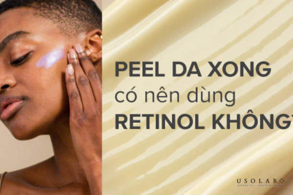 Peel xong có được dùng retinol không