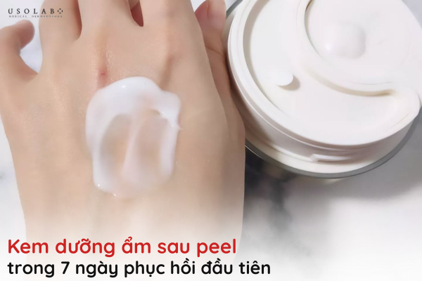 kem dưỡng ẩm sau peel