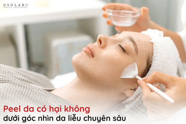 peel da có hại không