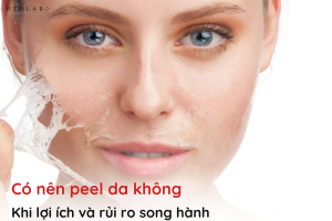 có nên peel da không