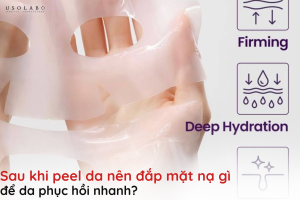 sau khi peel da nên đắp mặt nạ gì