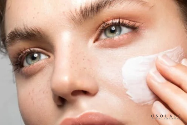 kem dưỡng ẩm sau peel