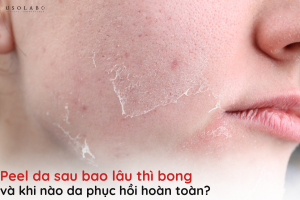 peel da sau bao lâu thì bong