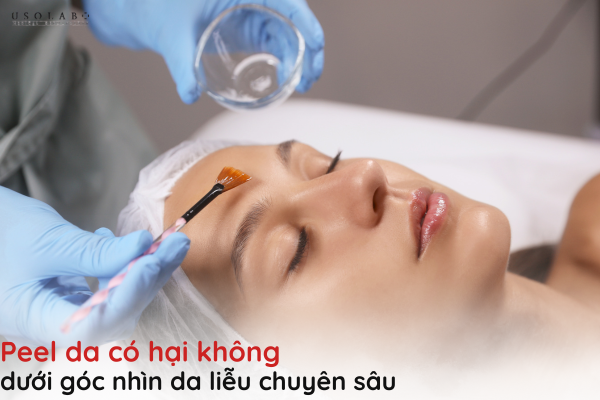 peel da có hại không