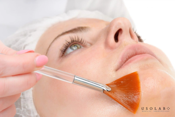 peel da sau bao lâu thì bong