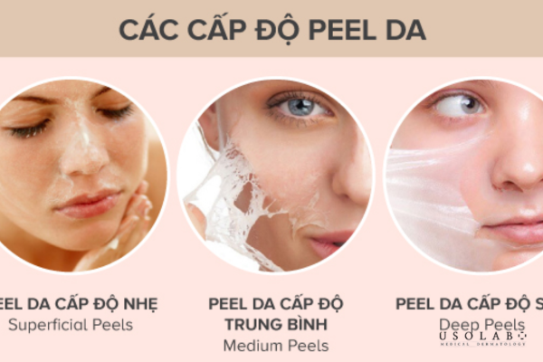 Cấp độ peel da sinh học tại spa Cấp độ peel da sinh học tại spa