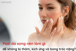 peel da xong nên làm gì
