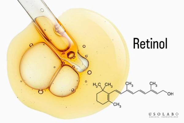 Không nên dùng retinol ngay sau peel, đặc biệt trong 5–7 ngày đầu Không nên dùng retinol ngay sau peel, đặc biệt trong 5–7 ngày đầu