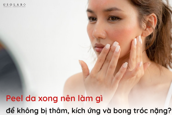 peel da xong nên làm gì