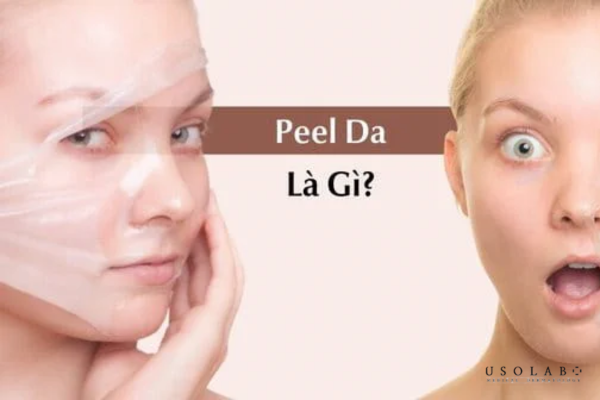 Peel da (chemical peel) là phương pháp sử dụng các hoạt chất acid ở nồng độ phù hợp Peel da (chemical peel) là phương pháp sử dụng các hoạt chất acid ở nồng độ phù hợp