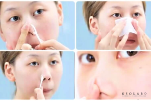 tinh chất đường đen trị mụn