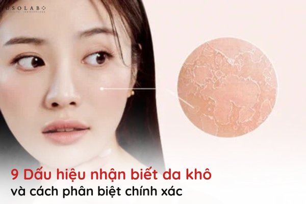 dấu hiệu nhận biết da khô