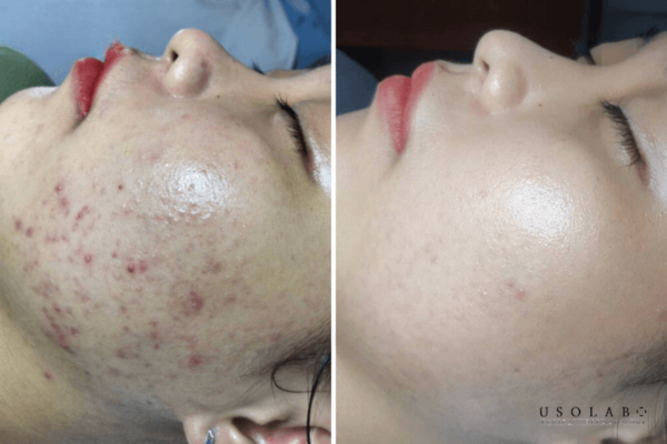 Vì sao cần xác định đúng loại da