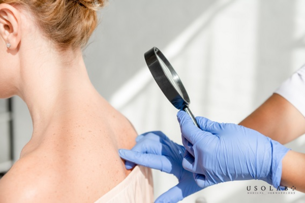 Khi nào nên gặp bác sĩ da liễu