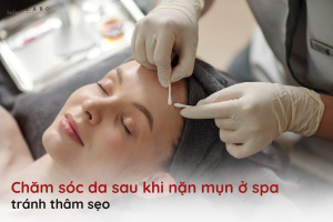 chăm sóc da sau khi nặn mụn ở spa
