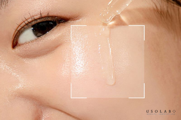 Sau khi nặn mụn nên dùng gì để phục hồi da Sau khi nặn mụn nên dùng gì để phục hồi da