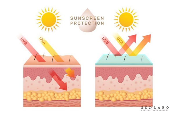 Tránh ánh nắng Tránh ánh nắng