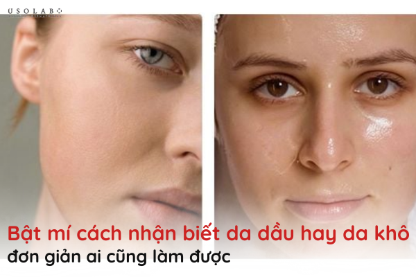 cách nhận biết da dầu hay da khô