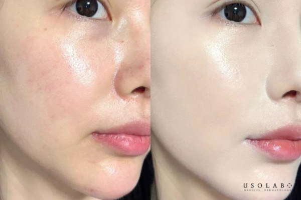 Tăng hiệu quả của các hoạt chất dưỡng ẩm khác: