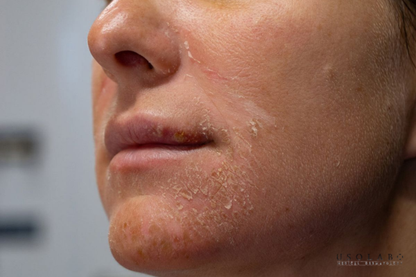 Là câu hỏi được nhiều người quan tâm khi tìm kiếm giải pháp phục hồi