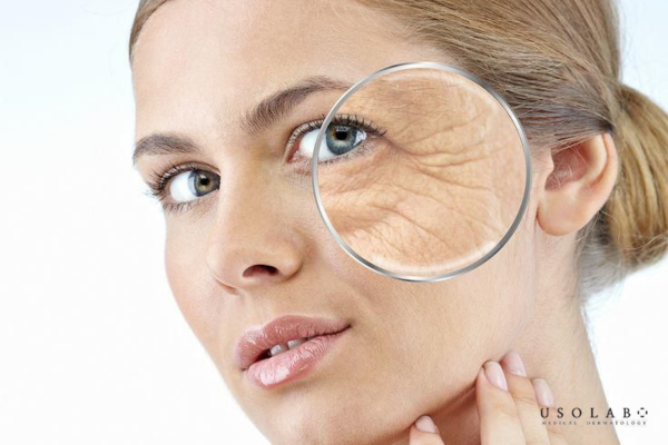 Không dùng kem dưỡng ẩm