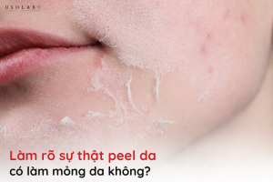 peel da có làm mỏng da không