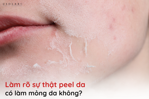 peel da có làm mỏng da không