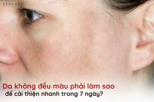 da không đều màu phải làm sao