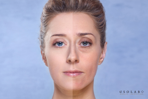 Độ ẩm trong da không được duy trì ổn định, quá trình tái tạo tế bào sẽ diễn ra chậm hơn Độ ẩm trong da không được duy trì ổn định, quá trình tái tạo tế bào sẽ diễn ra chậm hơn