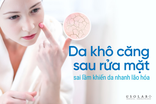 dấu hiệu nhận biết da khô rõ ràng nhất là cảm giác căng rít ngay sau khi rửa mặt dấu hiệu nhận biết da khô rõ ràng nhất là cảm giác căng rít ngay sau khi rửa mặt