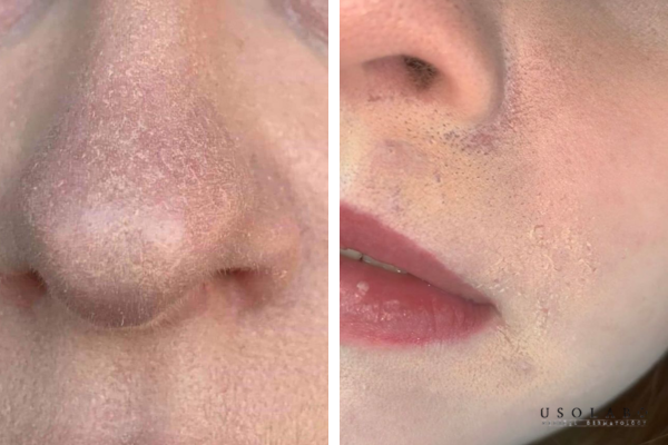 Makeup mốc nền Makeup mốc nền