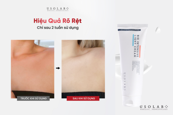 Muốn trắng nhanh - chọn tone up Muốn trắng nhanh - chọn tone up